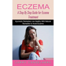Eczema: A Step By Step Guide for Eczema Treatment (Ayurvedic Remedies Live Healthy With Natural Remedies to Avoid Eczema)
