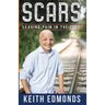 Scars Leaving Pain in the Past