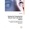 Seeing the Transplanted Mouse Heart Like Never Before