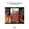 A-Z of First Trimester Sonography Atlas & Illustration