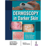 Dermoscopy in Darker Skin