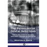 The Pathology of Dental Infections: and Its Relation to General Diseases - History of Dentistry