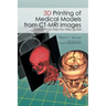 3D Printing of Medical Models from CT-MRI Images: A Practical step-by-step guide