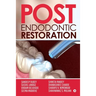 Post Endodontic Restoration