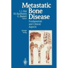 Metastatic Bone Disease: Fundamental and Clinical Aspects
