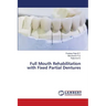 Full Mouth Rehabilitation with Fixed Partial Dentures