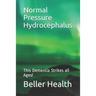 2019 Normal Pressure Hydrocephalus: This Dementia Strikes all Ages!