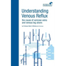 Understanding Venous Reflux the Cause of Varicose Veins and Venous Leg Ulcers: Varicose veins and venous leg ulcers