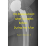 Hip Replacement: What To Expect Before, During and After