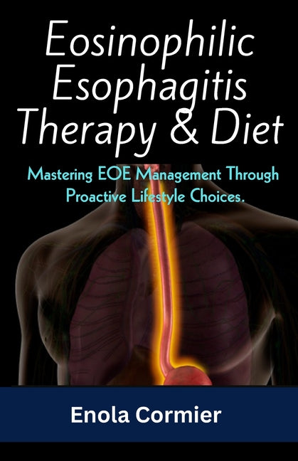 Eosinophilic Esophagitis Therapy & Diet: Mastering EOE Management Through Proactive Lifestyle Choices. - Paperback by Books by splitShops