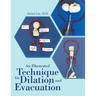 An Illustrated Technique for Dilation and Evacuation