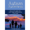 Autism Awareness: How to Recognize the Early Signs and Symptoms in Our Kids