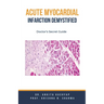 Acute Myocardial Infarction Demystified: Doctor's Secret Guide