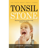 Tonsil Stones: The Truth about Tonsil Stones (Eliminate Tonsil Stones and Have Fresh Breath in Just Days!)