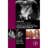 Cardiac MRI in Diagnosis, Clinical Management, and Prognosis of Arrhythmogenic Right Ventricular Cardiomyopathy/Dysplasia