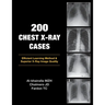 200 Chest X-Ray Cases