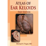 Atlas of Ear Keloids