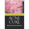 Acne Cure: Best Guide To Cure Acne Fast