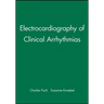 Electrocardiography of Clinical Arrhythmias