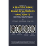 I Have a Beautiful Brain, Compared to the Brains of Alcoholics and Drug Addicts