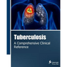 Tuberculosis: A Comprehensive Clinical Reference