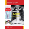 Sickle Cell Disease: The Evil Spirit of Misshapen Hemoglobin