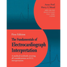 The Fundamentals of Electrocardiograph Interpretation: A medical textbook covering all considerations on ECG interpretation
