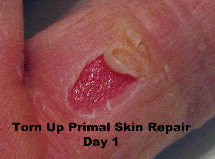 Torn Up Skin Repair by Primal Life Organics #1 Best Natural Dental Care