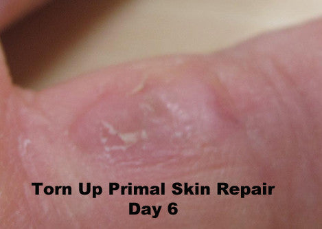 Torn Up Skin Repair by Primal Life Organics #1 Best Natural Dental Care