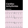 Cardiac Arrhythmias