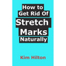 How to Get Rid Of Stretch Marks Naturally